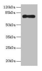 Polyclonal Rabbit anti-Human ALOX15B / 15-LOX-2 Antibody (aa1-676)