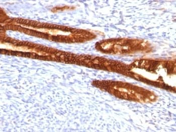 KRT7 / CK7 / Cytokeratin 7 Antibody (clone KRT7/760 + KRT7/903)