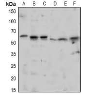 Polyclonal Rabbit anti-Human TAB1 Antibody (WB)