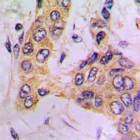 PDPK1 / PDK1 Antibody (Internal)