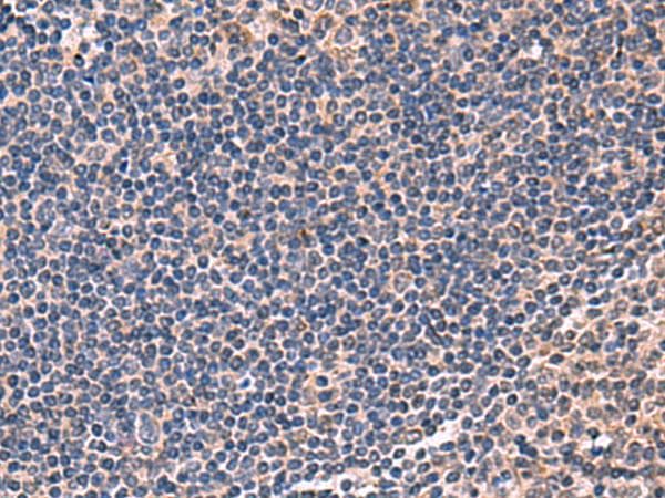 Polyclonal Rabbit anti-Human IPPK Antibody (IHC, WB)