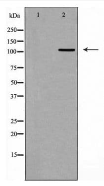 ITGB3 / Integrin Beta 3 / CD61 Antibody