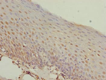 Polyclonal Rabbit anti-Human MEOX1 Antibody (IHC, WB)