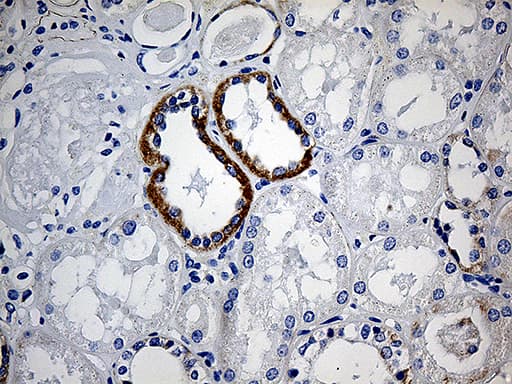 Monoclonal Mouse anti-Human CBR4 Antibody (clone OTI3C10, IHC)