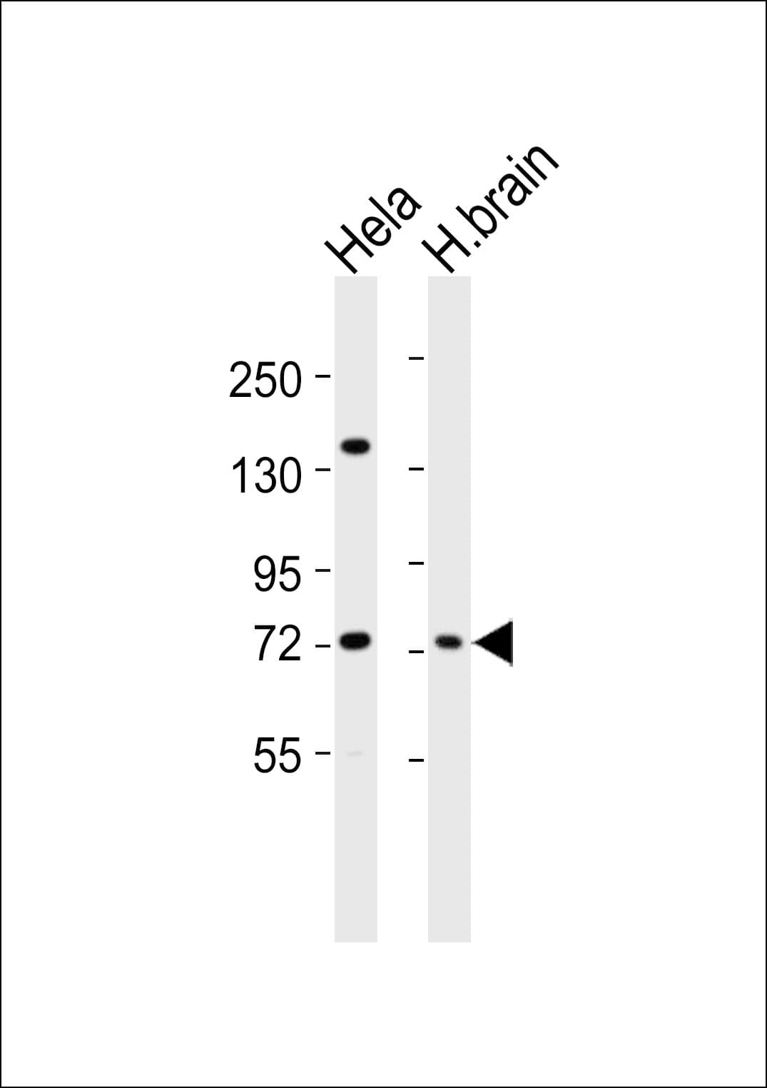 Polyclonal Rabbit anti-Human GRK6 Antibody (WB)
