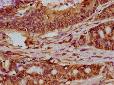 HIST1H2BN Antibody