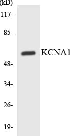 PathPlus™ KCNA1 / Kv1.1 Antibody (aa239-288)