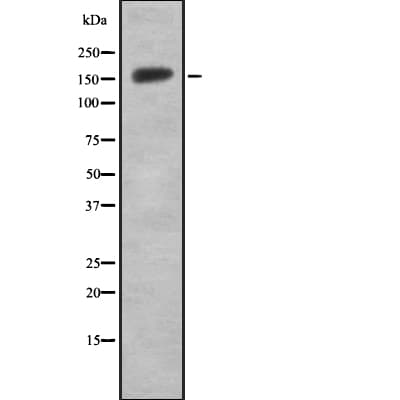 Polyclonal Rabbit anti-Human ERCC6 / CSB Antibody (IHC, WB)