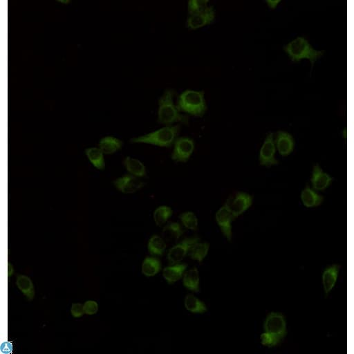 KRT8 / CK8 / Cytokeratin 8 Antibody