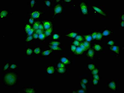 SLC25A4 / ANT Antibody