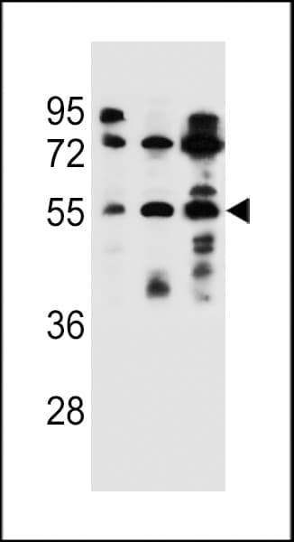 FUT6 Antibody (aa20-49)