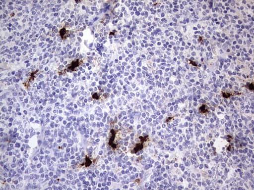 S100A9 / MRP14 Antibody (clone OTI2C5)