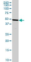 Monoclonal Mouse anti-Human HPD Antibody (clone 2F3, WB)