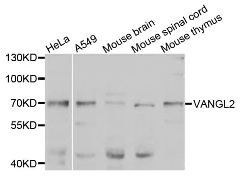 VANGL2 / LTAP Antibody