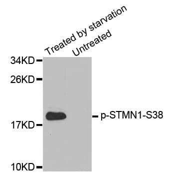 STMN1 / Stathmin / LAG Antibody (phospho-Ser38)