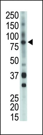 ETK / BMX Antibody (aa212-242)