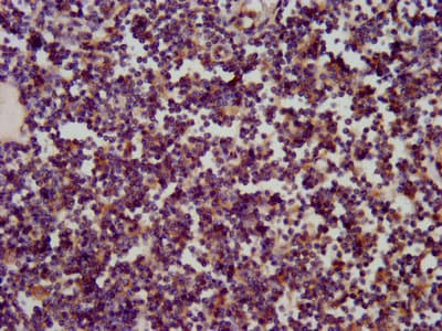 Polyclonal Rabbit anti-Human SKA1 Antibody (IHC)