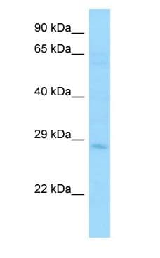 Polyclonal Rabbit anti-Human STC2 / Stanniocalcin 2 Antibody (C-Terminus, WB)