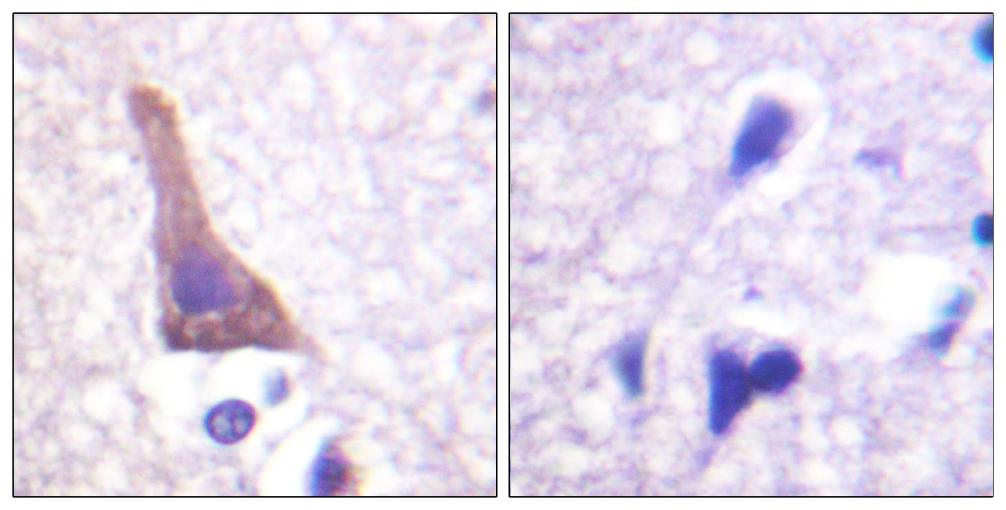 ADRB2 Antibody (phospho-Ser346)