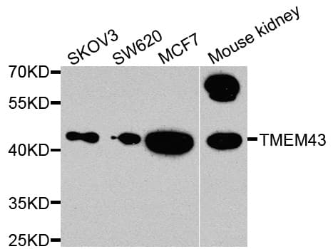 Polyclonal Rabbit anti-Human TMEM43 Antibody (WB)