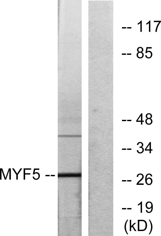 IHC-plus™ MYF5 / MYF 5 Antibody (aa61-110)