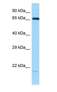 Heat Shock Protein 70 / HSPA1A Antibody (aa492-541)