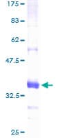 Human CTBS / CTB Protein (Recombinant GST)