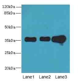 Polyclonal Rabbit anti-Human FAM82B Antibody (IHC, WB)