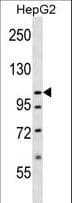 Polyclonal Rabbit anti-Human SLC12A7 / KCC4 Antibody (aa89-117, IHC, WB)