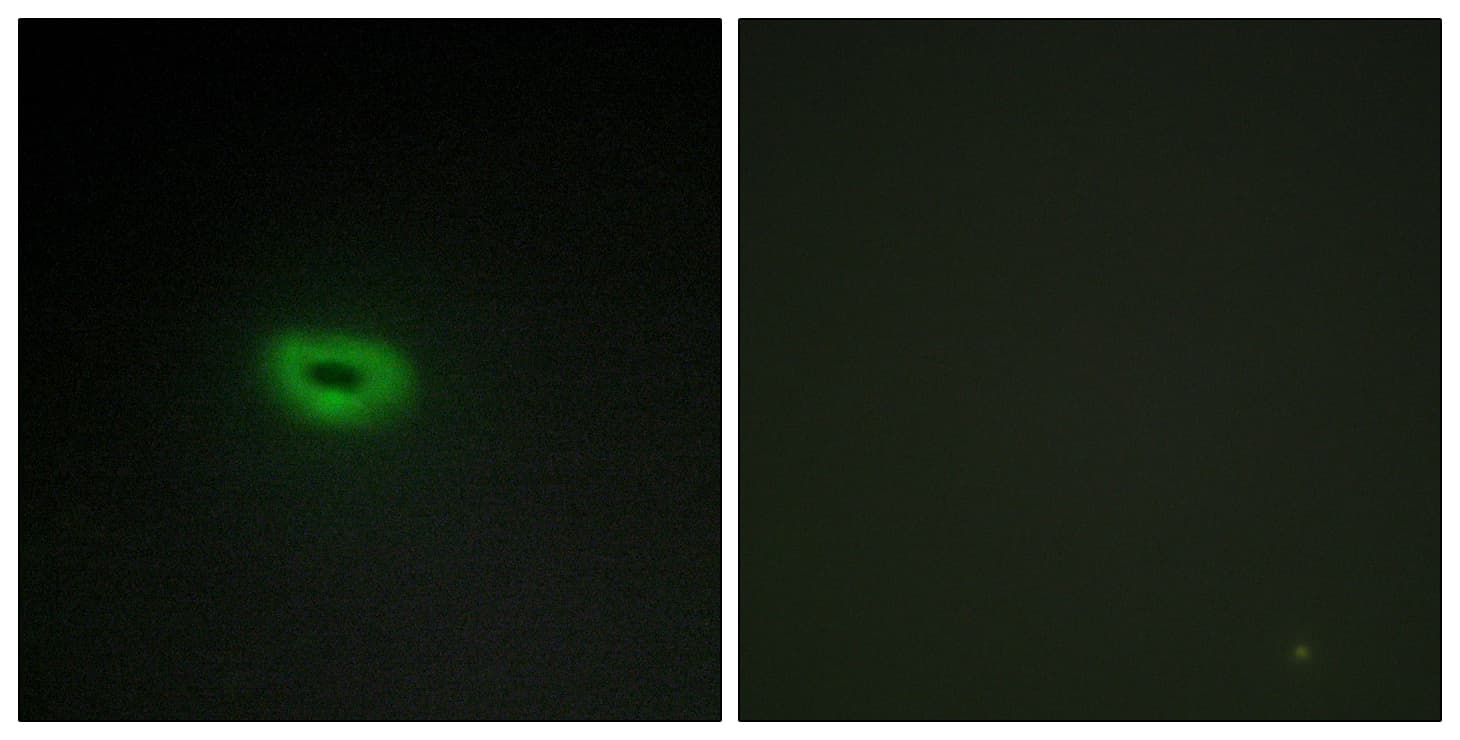 Polyclonal Rabbit anti-Human C2orf40 / ECRG4 Antibody (aa41-90, IHC, IF)