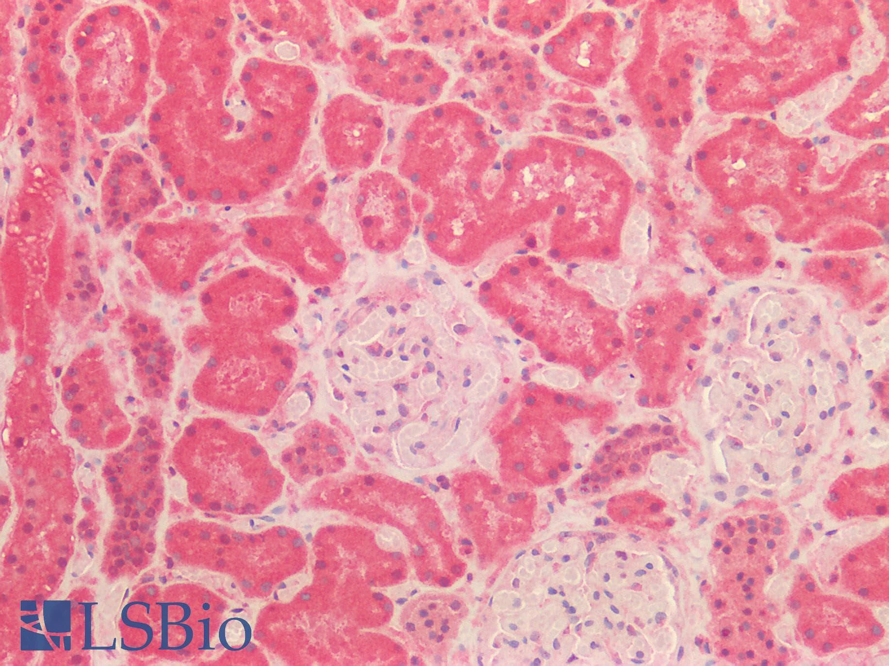 ORAOV1 Antibody