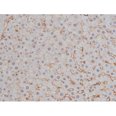 NPM1 / NPM / Nucleophosmin Antibody (phospho-Thr199)