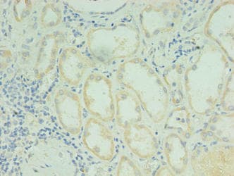 RDH12 / LCA3 Antibody (aa1-316)