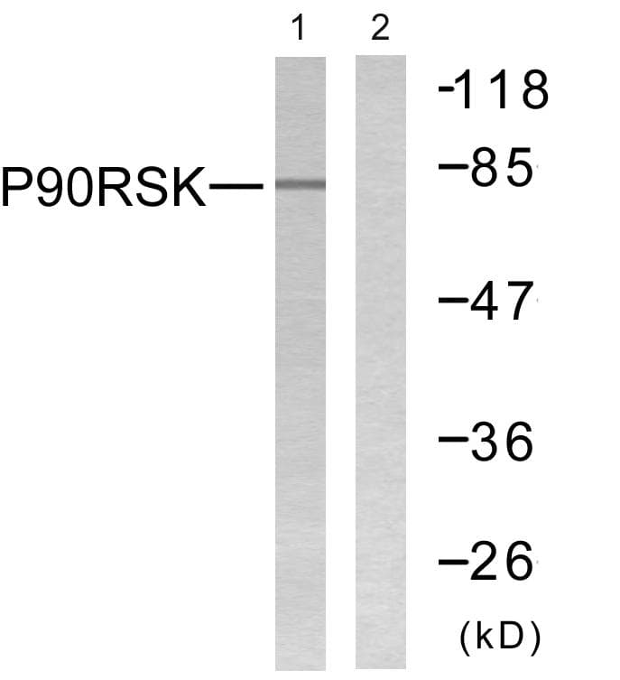 RPS6KA1 / RSK1 Antibody (p359/363)