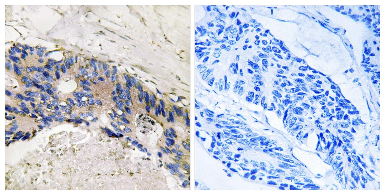 CA1 / Carbonic Anhydrase I Antibody