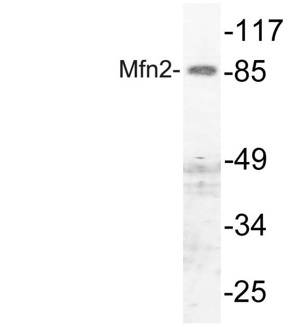 Mitofusin 2 / MFN2 Antibody (aa354-403)