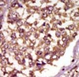 ETK / BMX Antibody (aa212-242)