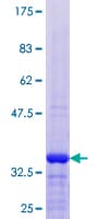 Human ASXL1 Protein (Recombinant GST)