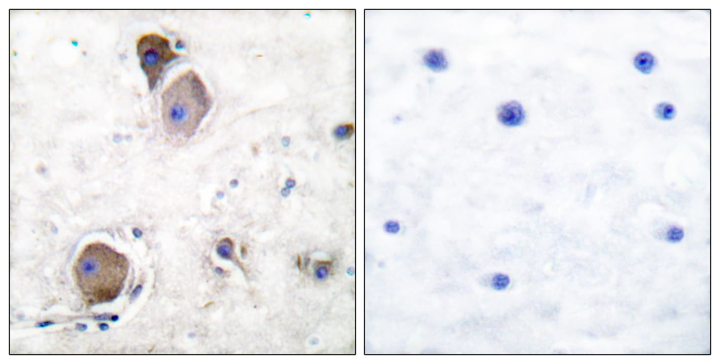 Polyclonal Rabbit anti-Human LYN Antibody (phospho-Tyr507, IHC, WB)
