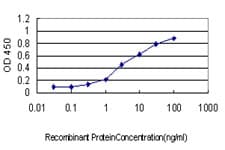 GCK / Glucokinase Antibody (clone 3C7)