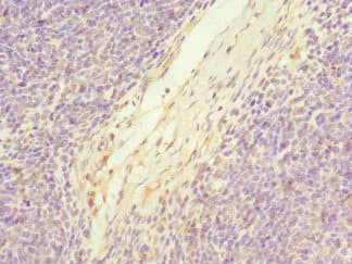 Polyclonal Rabbit anti-Human C19orf48 Antibody (IHC, IF)