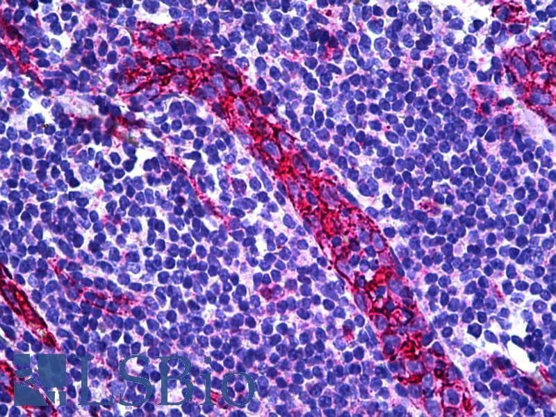 IHC-plus™ PECAM-1 / CD31 Antibody (aa686-735)