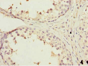 KBTBD7 Antibody