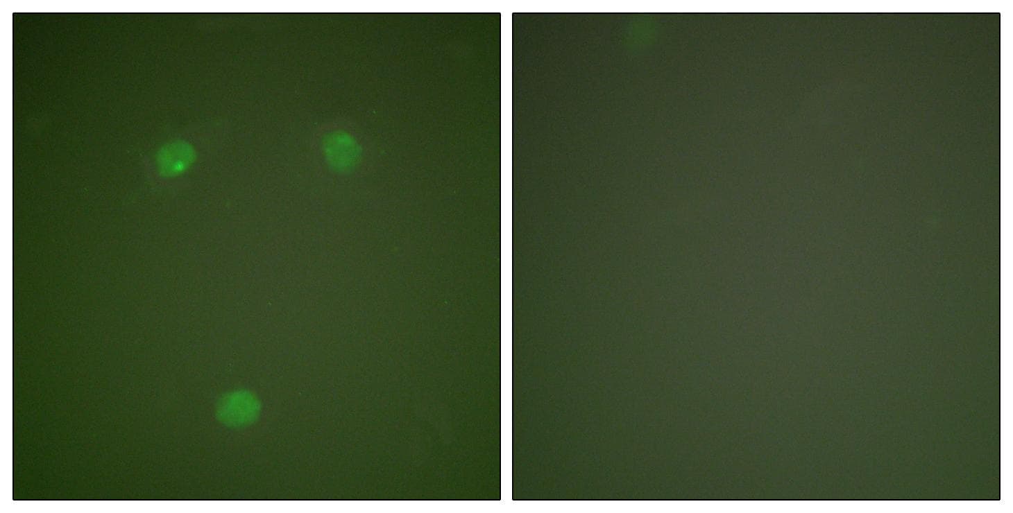 DDIT3 / CHOP Antibody