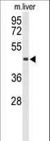 Polyclonal Rabbit anti-Human CHIA / Amcase Antibody (aa20-47, WB)