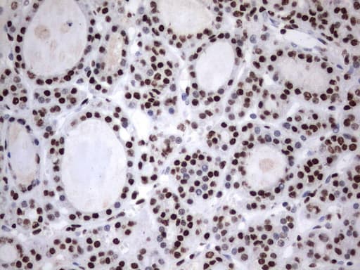MLF1 Antibody (clone UMAB138, Carrier-free)