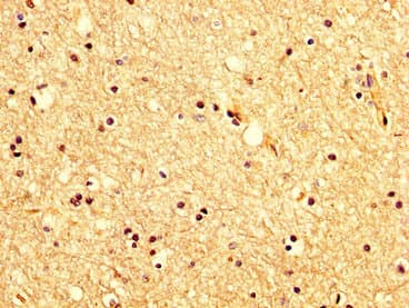 KCNAB1 Antibody