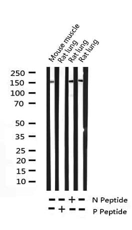 PLCG2 / PLC Gamma 2 Antibody (phospho-Tyr753)