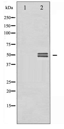 GSK3 Alpha+Beta Antibody (phospho-Tyr279/216)