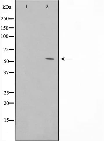 NR1I2 / PXR Antibody